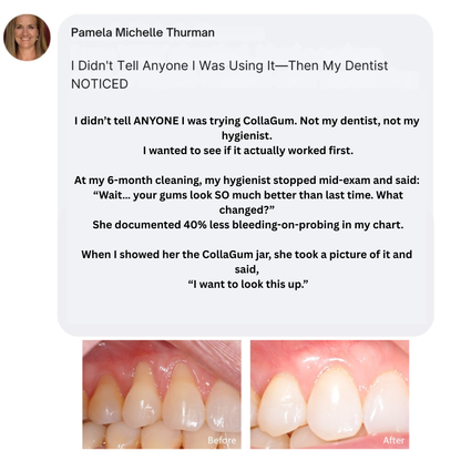 CollaGum™ – Daily Support for Receding Gums, Sensitivity & Gum Weakness