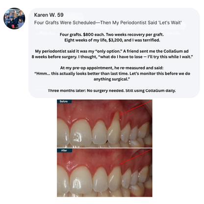 CollaGum™ – Daily Support for Receding Gums, Sensitivity & Gum Weakness