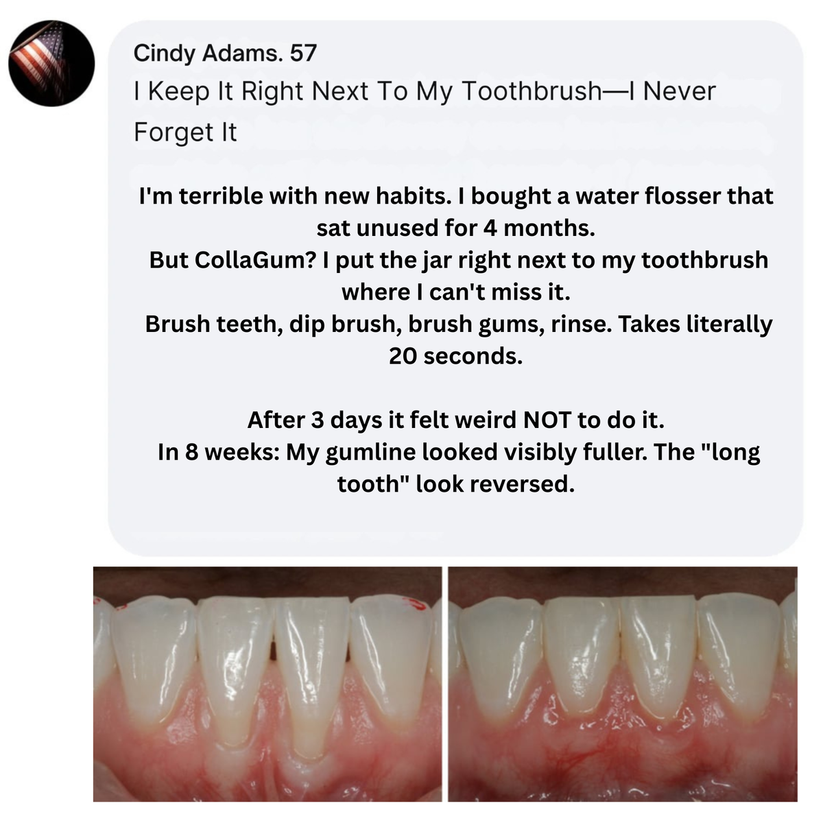 CollaGum™ – Daily Support for Receding Gums, Sensitivity & Gum Weakness